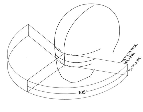 Figure 4: Lateral View