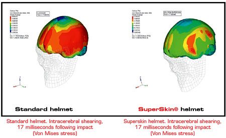 Lazer Helmets SuperSkin - Intracerebral Shearing Graphic