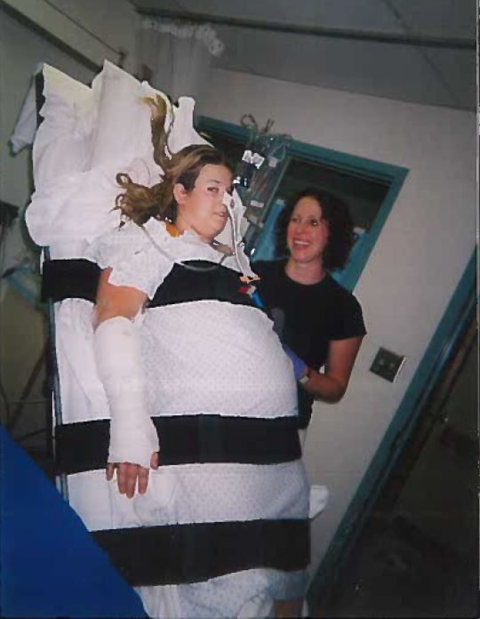 Physical therapy is grueling