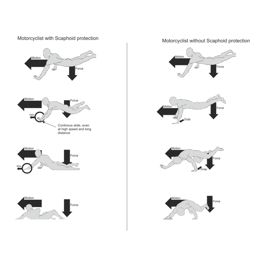 Graphic illustration of how the Scaphoid Protection System works