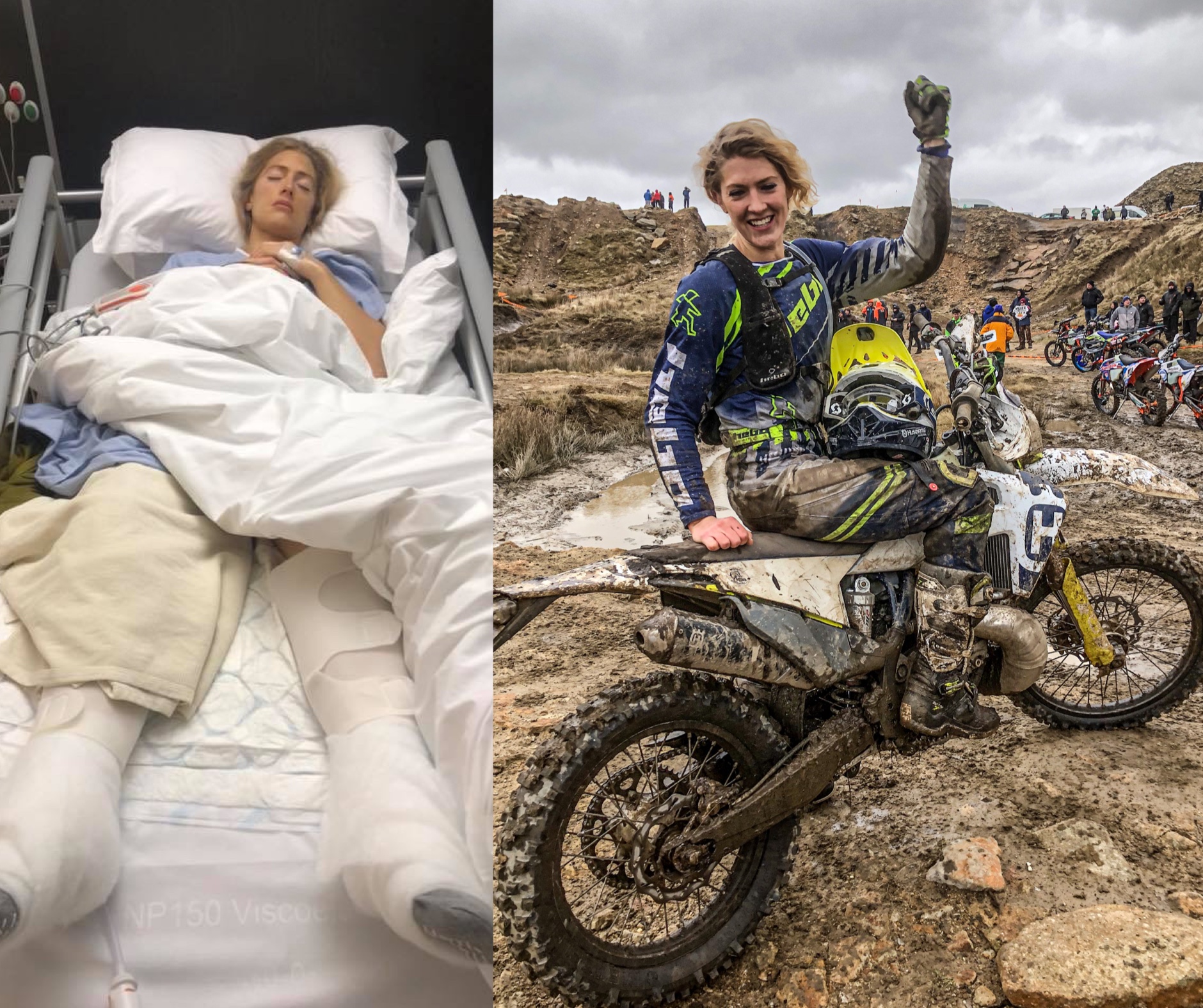 Vanessa Ruck, mid-recovery from her accident and post-surgeries, enjoying hard enduro