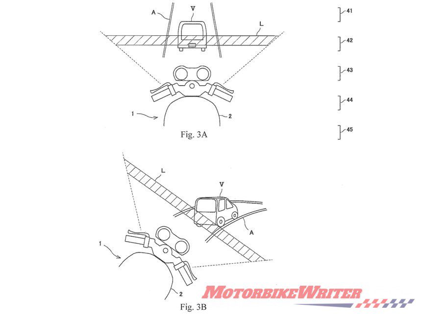 Kawasaki sensory overload patent