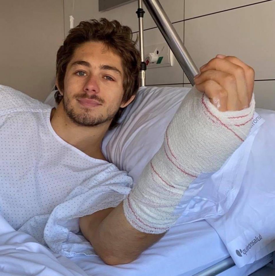 Remy Gardner sporting broken. limbs as a result of his expertise on the Moto2 circuit