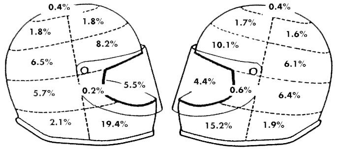 helmet injuries